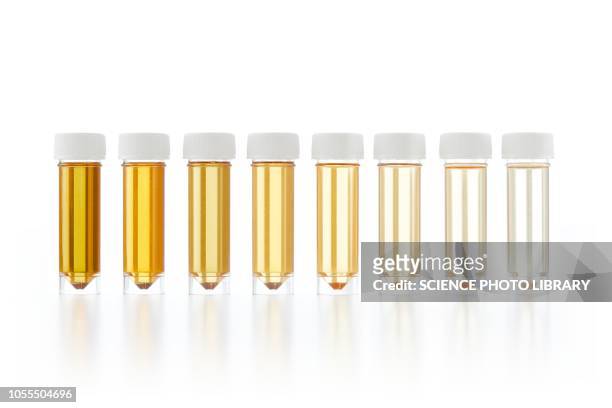 urine samples for analysis - urine sample ストックフォトと画像
