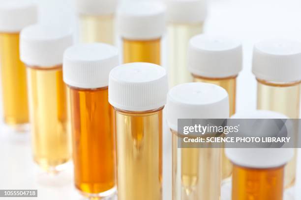 Urine Sample Example Empty Urine Sample Photos and Premium High Res Pictures - Getty Images