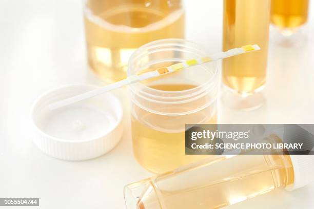 urine samples for analysis and test strip - urine sample ストックフォトと画像