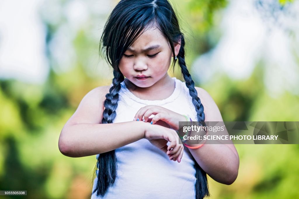 Girl scratching her hand