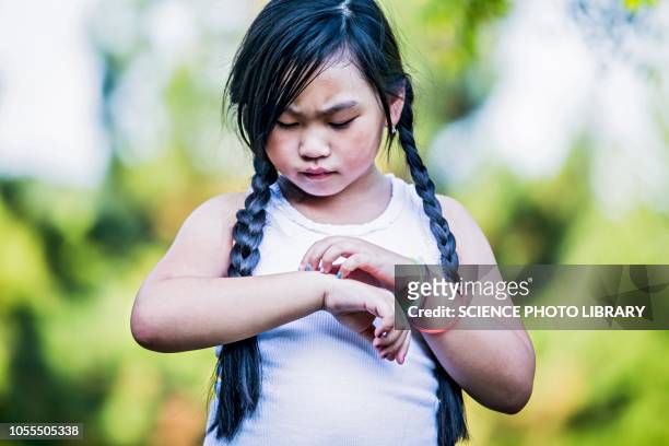 girl scratching her hand - allergies stock pictures, royalty-free photos & images