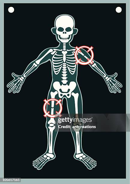 human body x ray - leg bone stock illustrations
