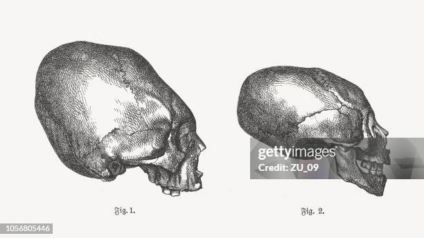 artificial cranial deformation of humans, wood engravings, published in 1897 - of deformed people stock illustrations