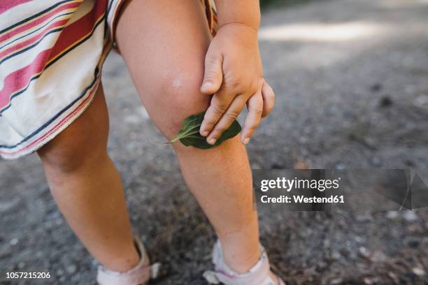 little girl covering scratch on knee with leaf, partial view - standing with hands on knees imagens e fotografias de stock