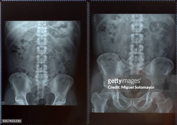 abdominal radiology - animal abdomen fotografías e imágenes de stock