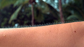 MACRO, DOF: Unknown adult person twists their arm to show their goosebumps.