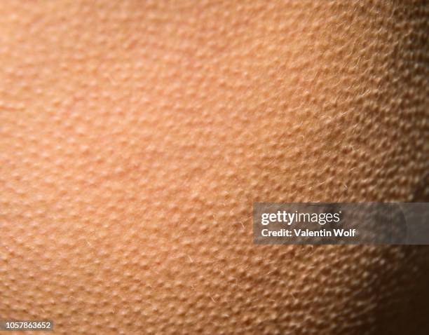 Uniform Goosebump Rash 302 Goose Bumps Skin Stock Photos, High-Res Pictures, and Images ...