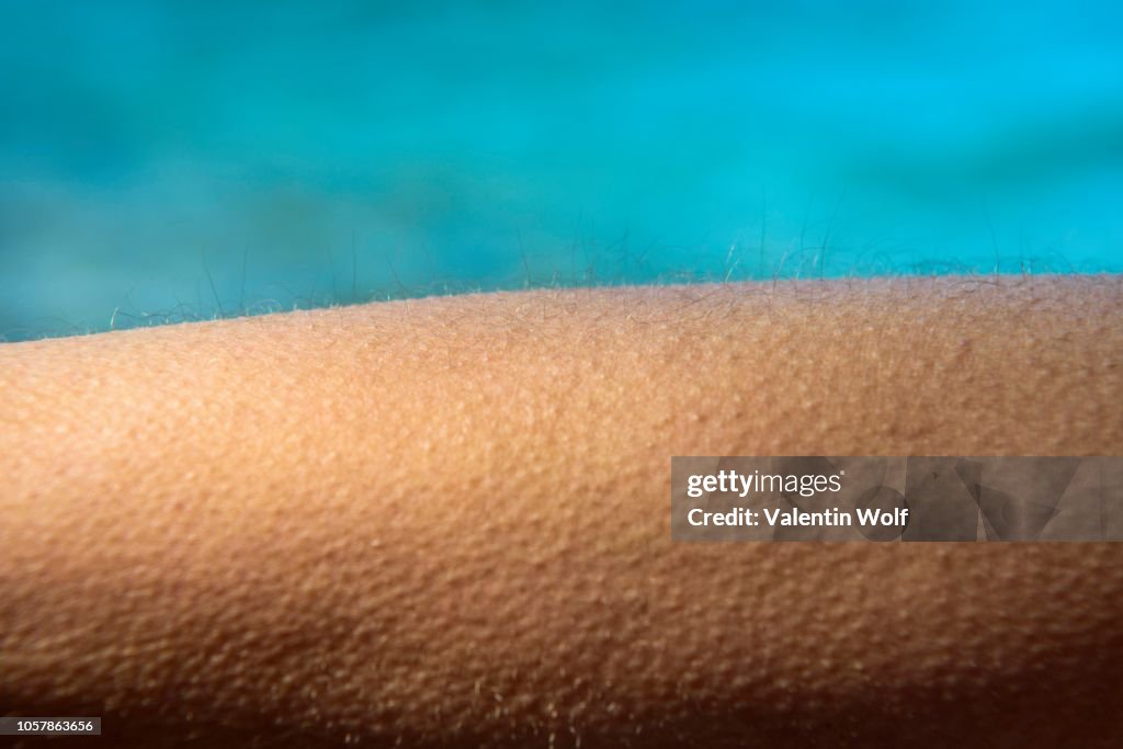 Goose bumps, close-up, detail, Germany