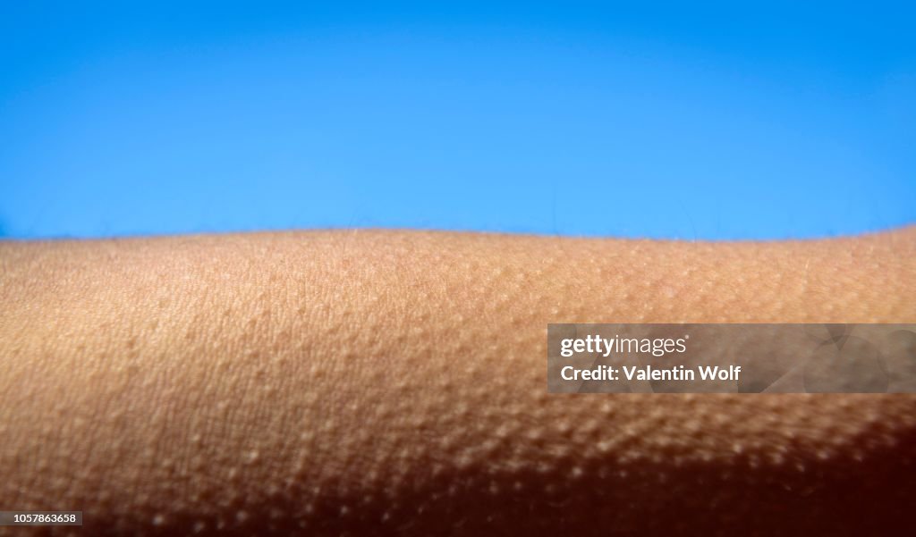Goose bumps, close-up, detail, Germany