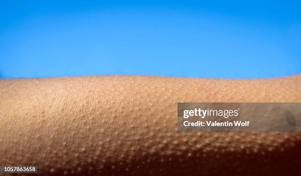 goose bumps, close-up, detail, germany - goosebumps up close stock pictures, royalty-free photos & images