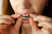 young woman puts transparent aligner for dental treatment