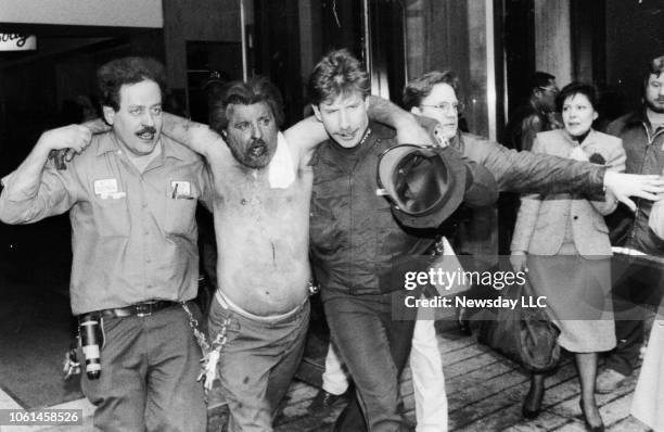 An injured man is helped away from the scene of a bombing at the World Trade Center in New York City on February 26, 1993.