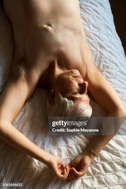A mature woman with mastectomy scars lying on the bed