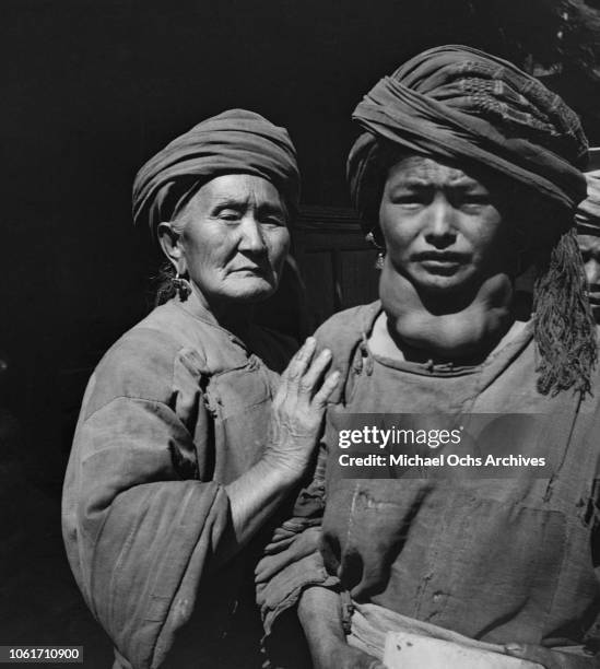 Gouter Belt 639 Goitre Stock Photos, High-Res Pictures, and Images - Getty Images