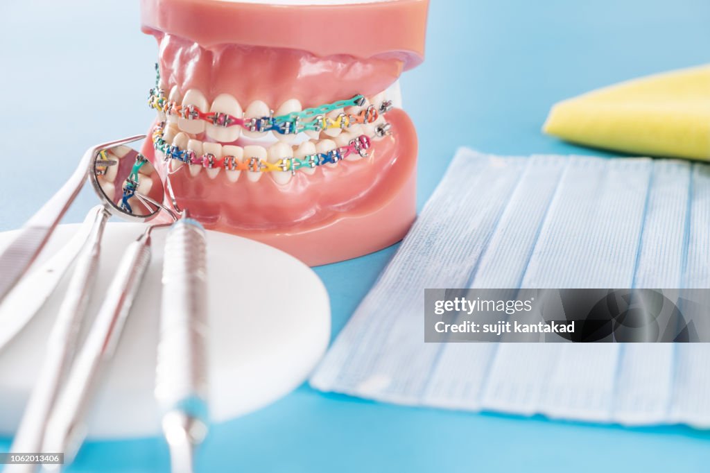 Dentisti e modello ortodontico.