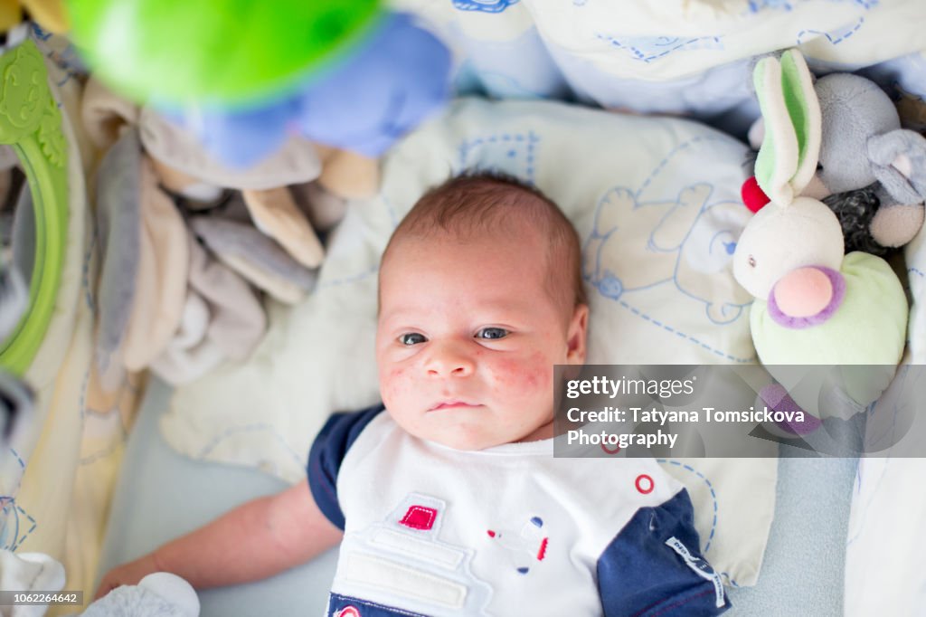 Cute newborn baby boy, playing in crib, newborn acne rash on his face