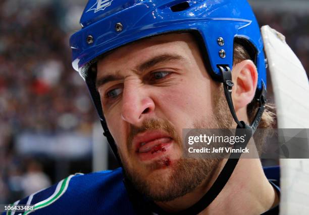 Tanner Glass of the Vancouver Canucks has a new set of stitches on his lower lip after a fight during their game against the New Jersey Devils at...