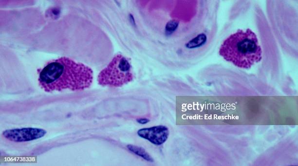 mast cells in connective tissue, 250x - anticoagulant - fotografias e filmes do acervo