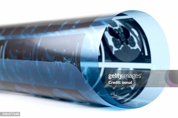 Mri Film Examples 117 Epilepsy Mri Stock Photos, High-Res Pictures, and Images - Getty Images