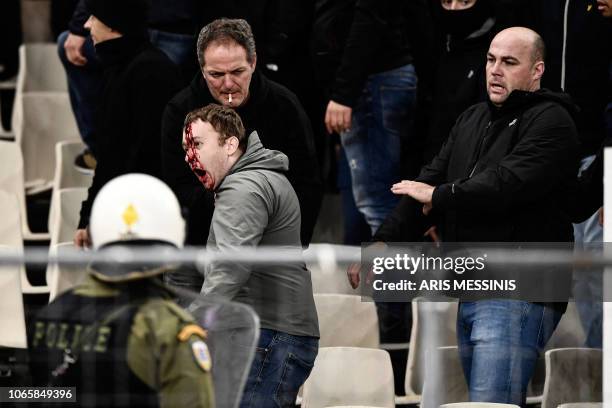 Bleeding Ajax fan reacts after clashes with Greek riot police prior to the start of the UEFA Champions League football match between AEK Athens FC...