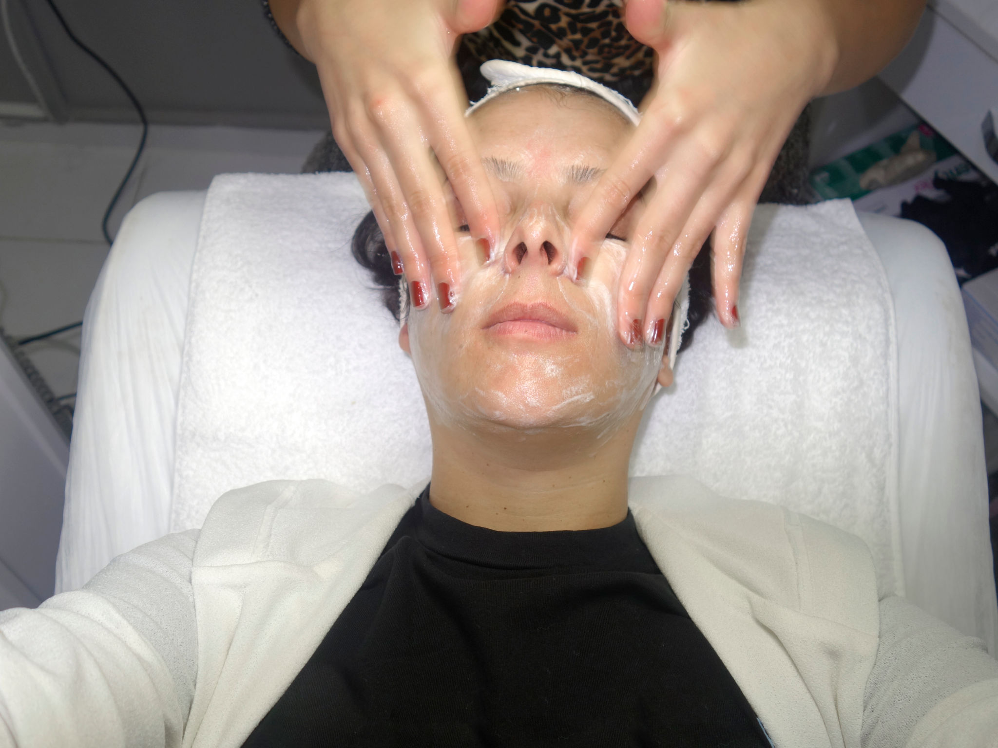 tratamiento facial
