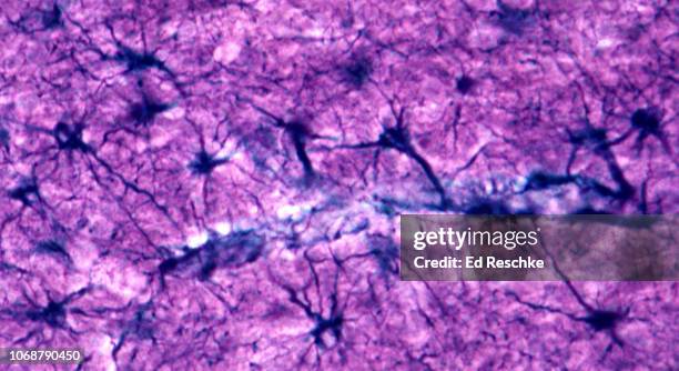 astrocytes (neuroglial cells) in the brain--many associated with a brain capillary, 100x - astrocyte stockfoto's en -beelden