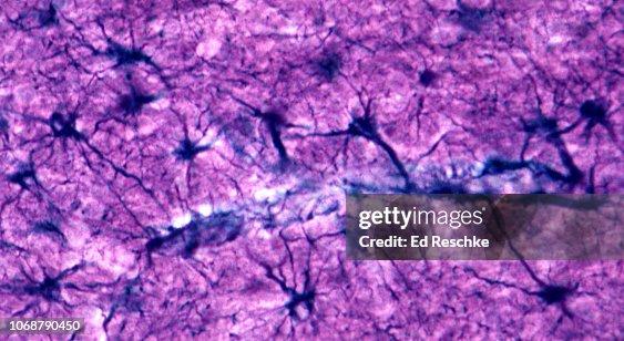ASTROCYTES (NEUROGLIAL CELLS) in the BRAIN--many associated with a brain CAPILLARY, 100X ASTROCYTES (NEUROGLIAL CELLS) in the BRAIN--many associated with a brain CAPILLARY, 100X