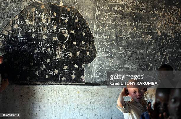 An albino child attends class on January 28, 2009 at the Mitindo Primary School for the blind, which has become a rare sanctuary for albino children....