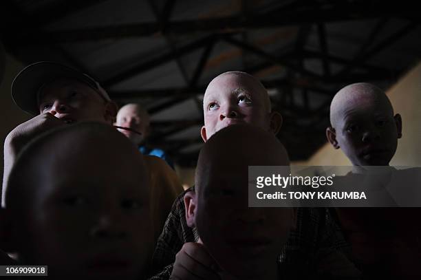 Albino children take a break on January 25, 2009 in a recreational hall at the Mitindo Primary School for the blind, which has become a rare...