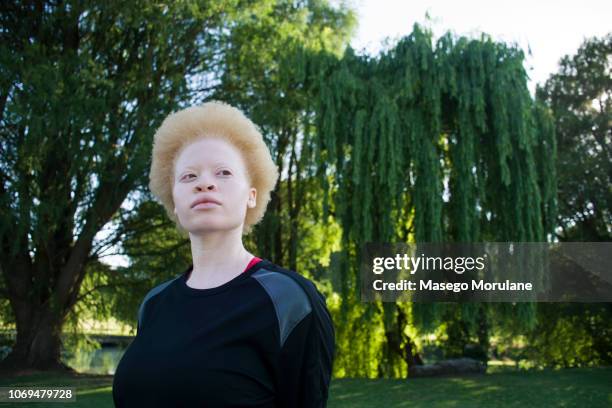 looking into the distance - albino stock pictures, royalty-free photos & images