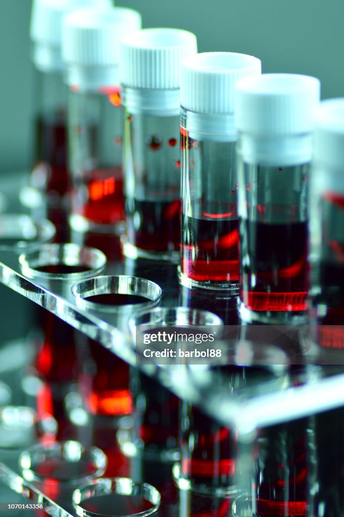 Blood Laboratory Tests High-Res Stock Photo - Getty Images