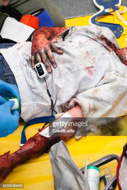 first aid paramedic training - emergency treatment - burns victims stock pictures, royalty-free photos & images