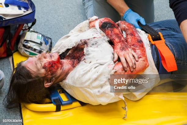 first aid paramedic training - fixating a patient - burns victims stock pictures, royalty-free photos & images