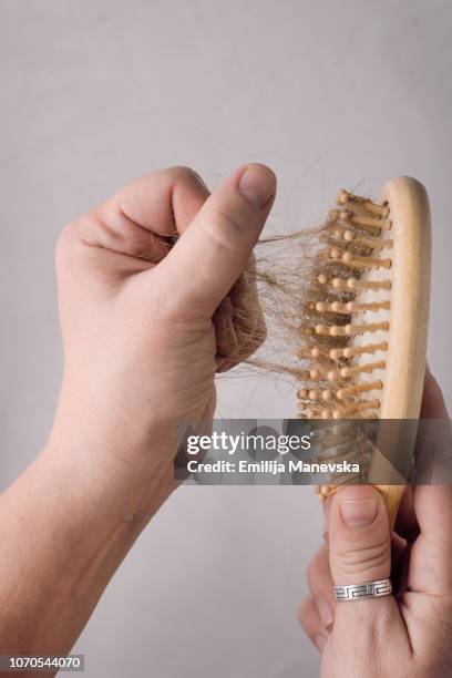 hair loss. hairbrush with hair stuck in it - slip stock pictures, royalty-free photos & images