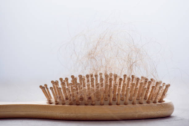 Veja a importância de manter sua escova de cabelo limpa hair loss. hairbrush with hair stuck in it - escova de cabelo - fotografias e filmes do acervo