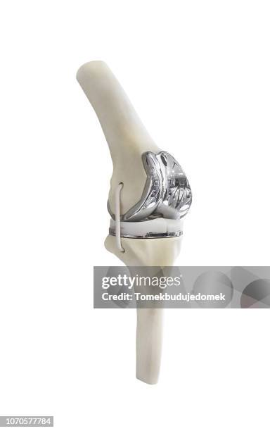 knee - prosthetic equipment stock pictures, royalty-free photos & images
