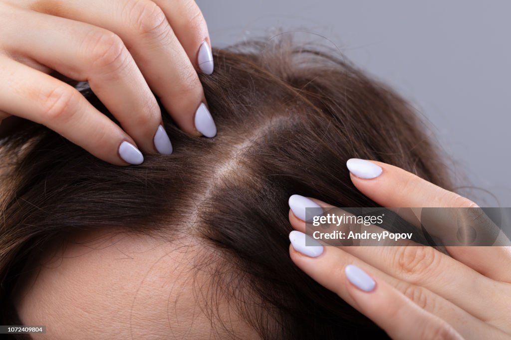 Vrouw met dunner wordend haar