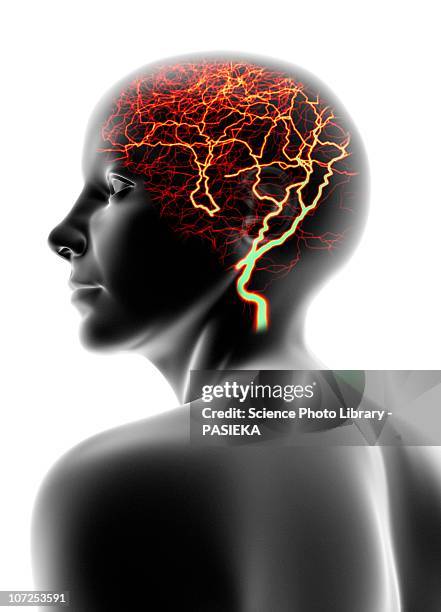 illustrazioni stock, clip art, cartoni animati e icone di tendenza di headache, conceptual image - epilessia