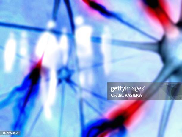 alzheimer's disease - memory loss stock illustrations