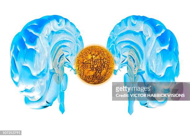 ilustrações, clipart, desenhos animados e ícones de brain cancer, conceptual artwork - tumor cerebral