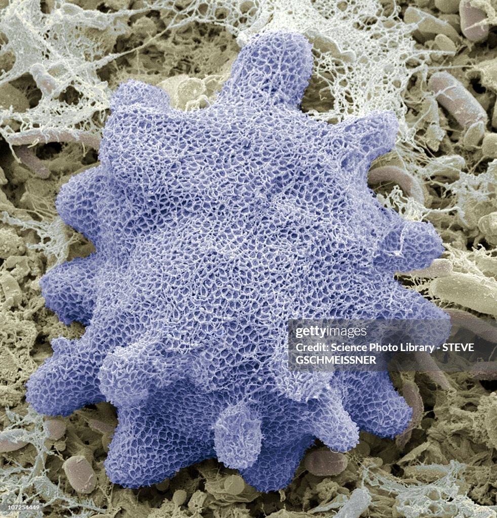 Korotnevella amoeba, SEM