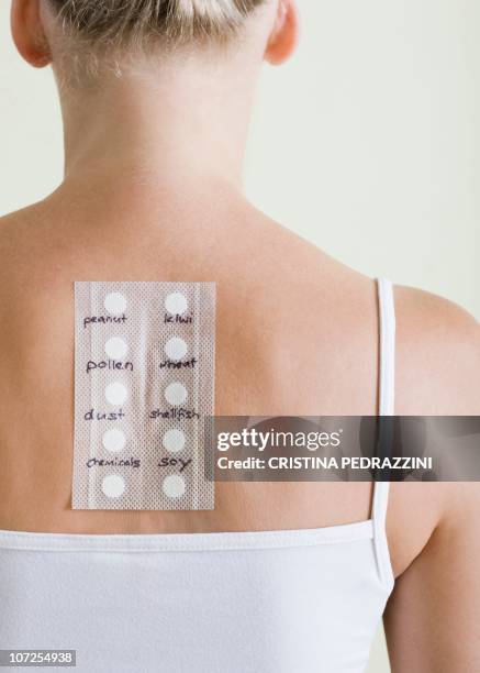 allergy test - test allergologico foto e immagini stock