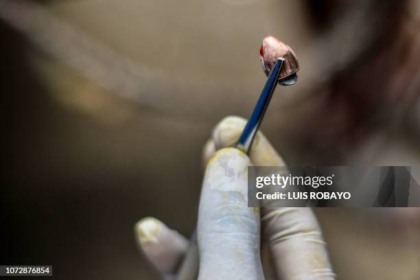 Veterinarian shows a bullet extracted from Dominga, a pregnant mare who received a stray bullet during clashes between criminal gangs, at Aguablanca...