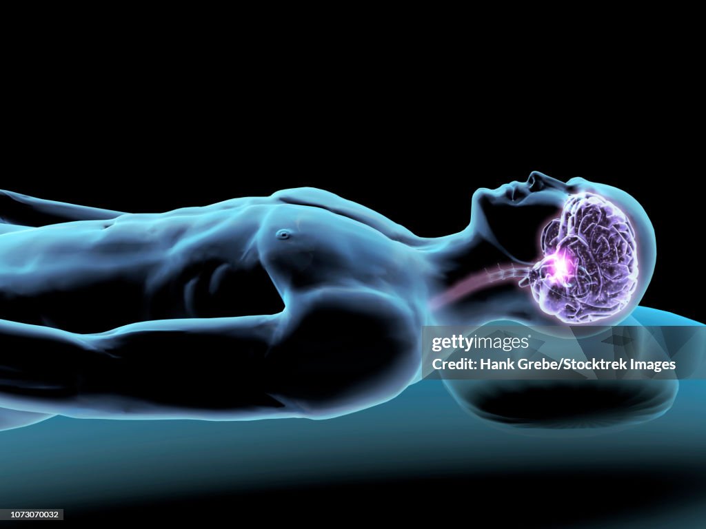 X-ray of sleeping man with brain.