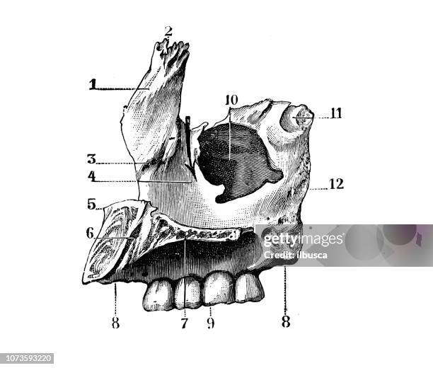 Netter Maxilla Antique Illustration Of Human Body Anatomy Bones Skull Maxilla Upper ...