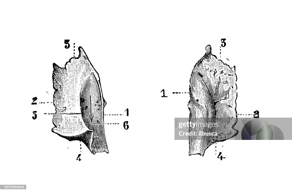 Lacrimal Bones Lacrimal Fossa
