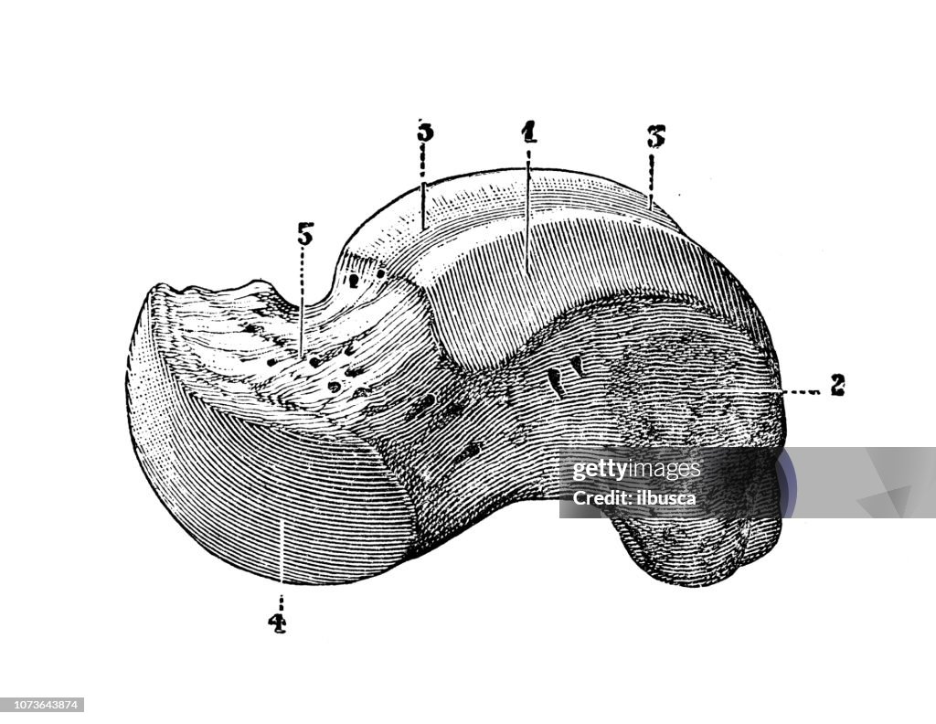 Talus Diffusion Talus Bone Labeled