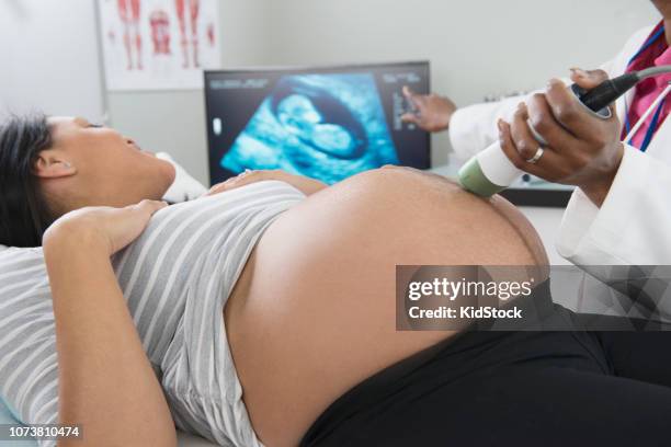 doctor performing ultrasound on pregnant woman - performing arts event stockfoto's en -beelden