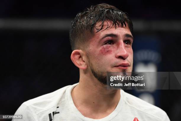Sergio Pettis reacts to his loss to Rob Font in their bantamweight bout during the UFC Fight Night event at Fiserv Forum on December 15, 2018 in...