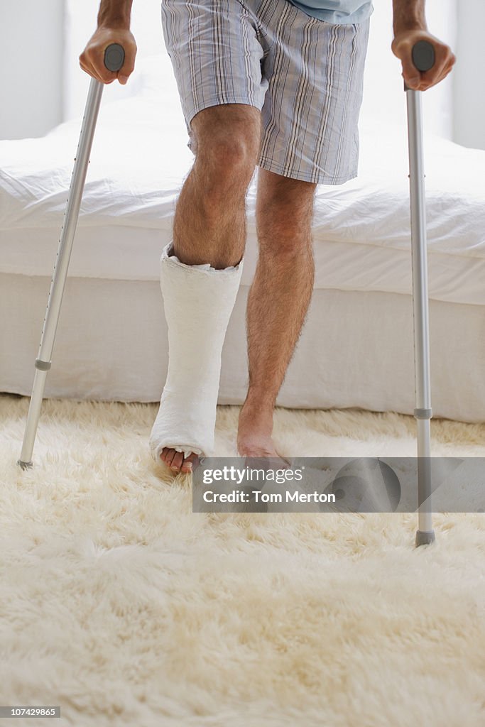 Mann mit einem gebrochenen Bein zu Fuß auf Krücken